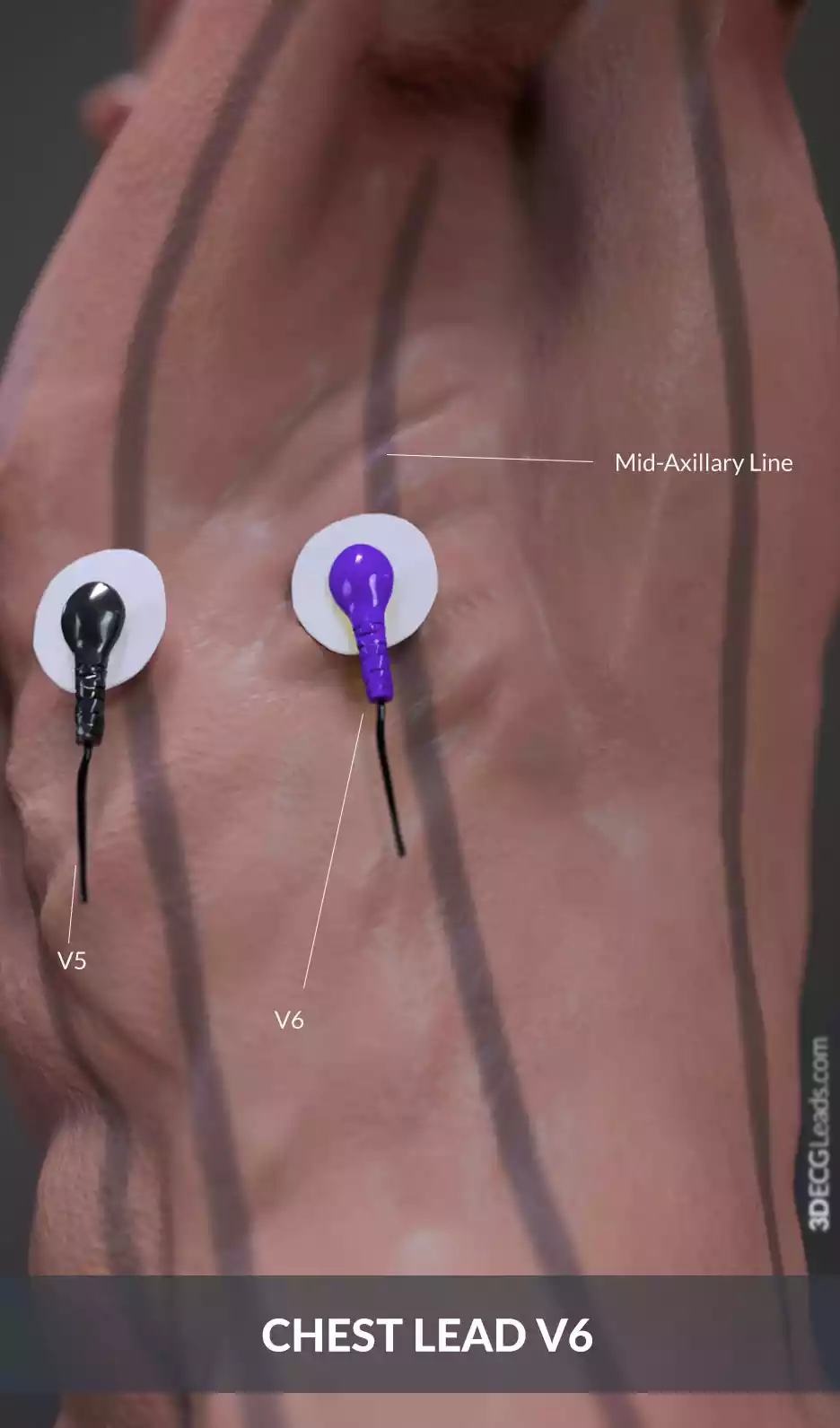 where to place ecg leads on chest